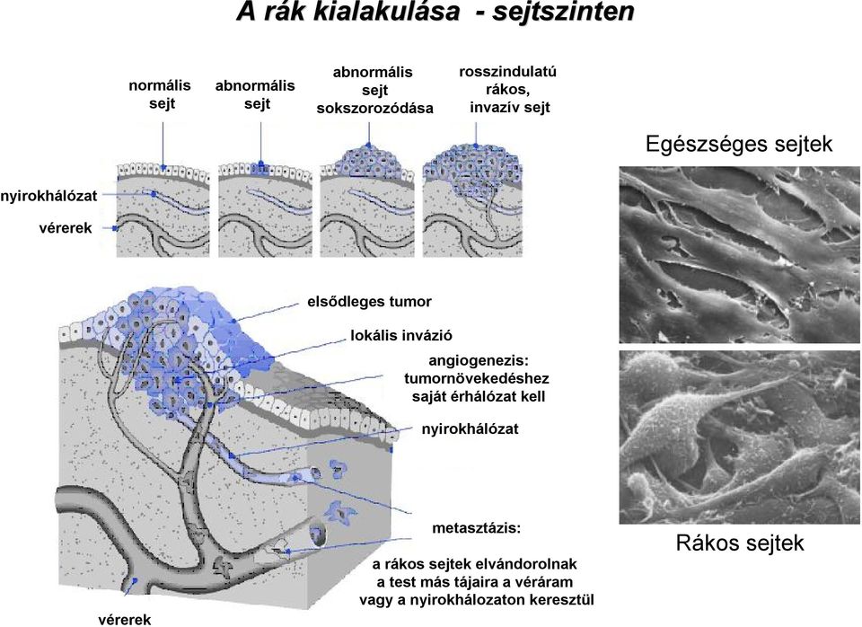 invázió angiogenezis: tumornövekedéshez saját érhálózat kell nyirokhálózat vérerek metasztázis: a