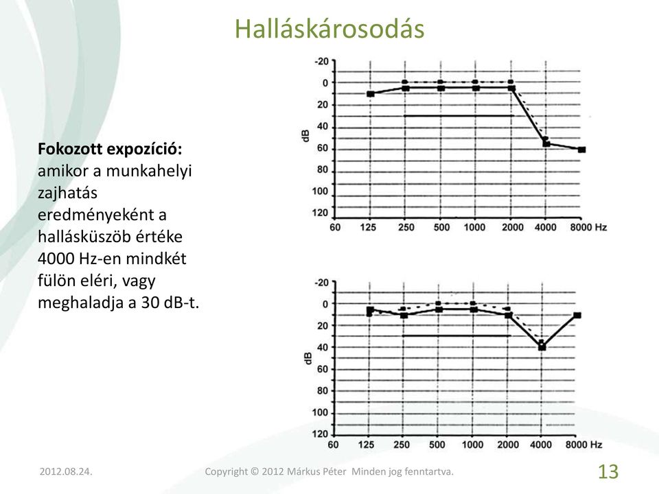 eredményeként a hallásküszöb értéke 4000