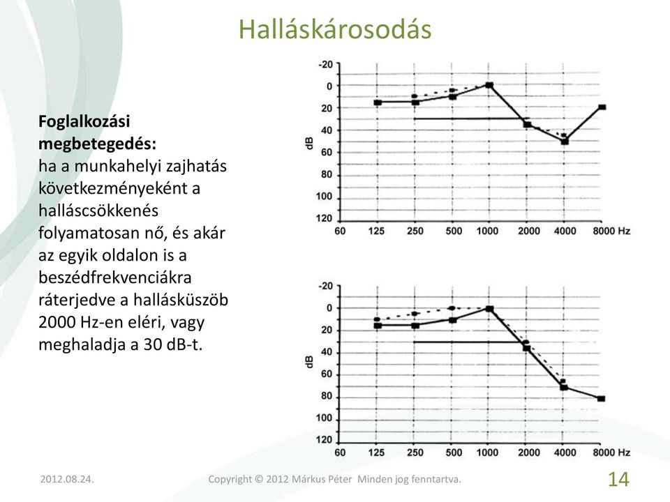 nő, és akár az egyik oldalon is a beszédfrekvenciákra