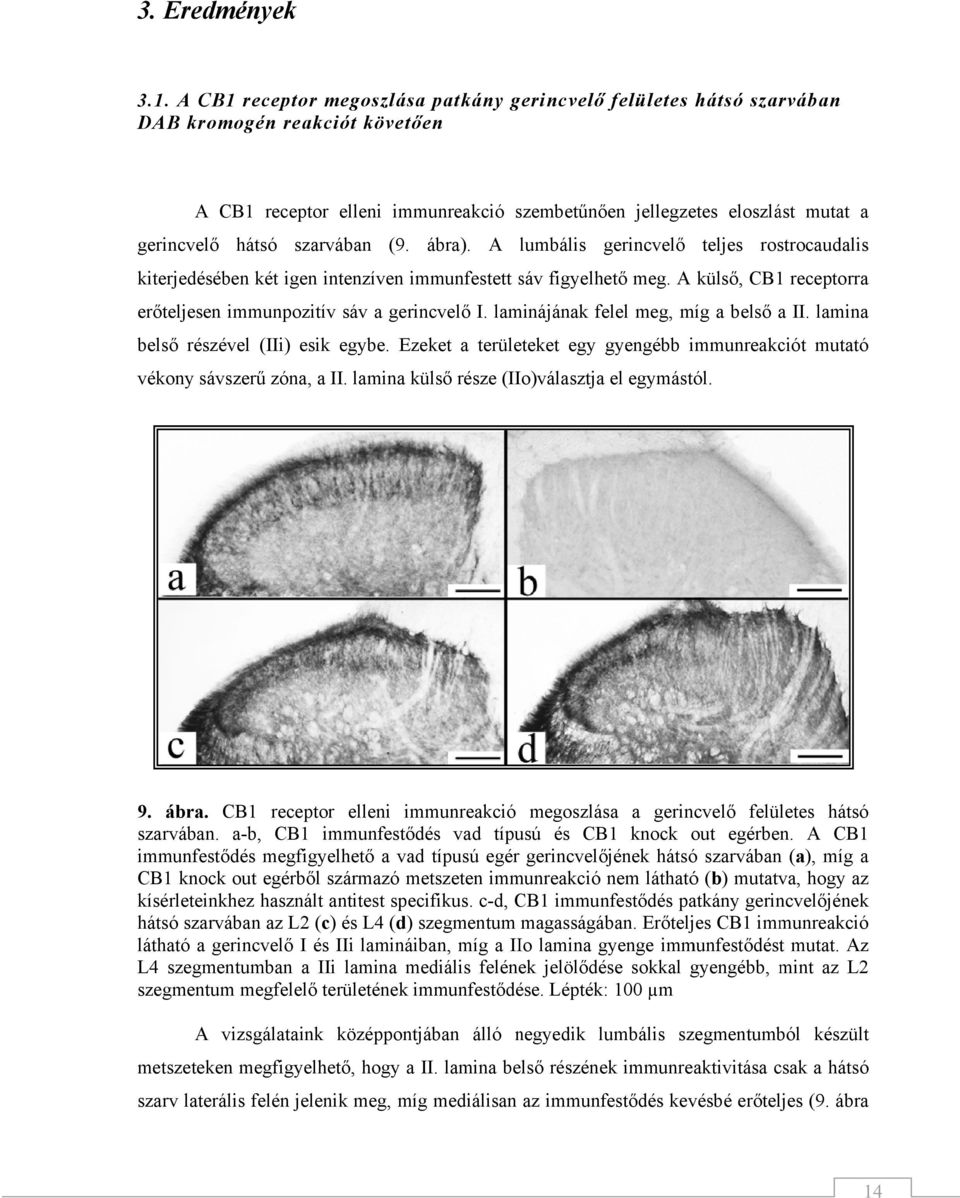 szarvában (9. ábra). A lumbális gerincvelő teljes rostrocaudaliss kiterjedésében két igen intenzíven immunfestett sáv figyelhető meg.