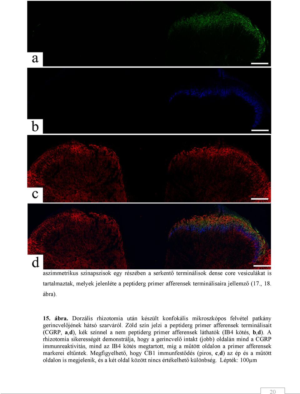 Zöld szín jelzi a peptiderg primer afferensek terminálisait (CGRP, a,d), kék színnel a nem peptiderg primer afferensek láthatók (IB4 kötés, b,d).