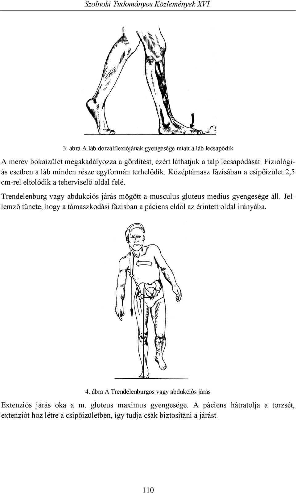 Trendelenburg vagy abdukciós járás mögött a musculus gluteus medius gyengesége áll.