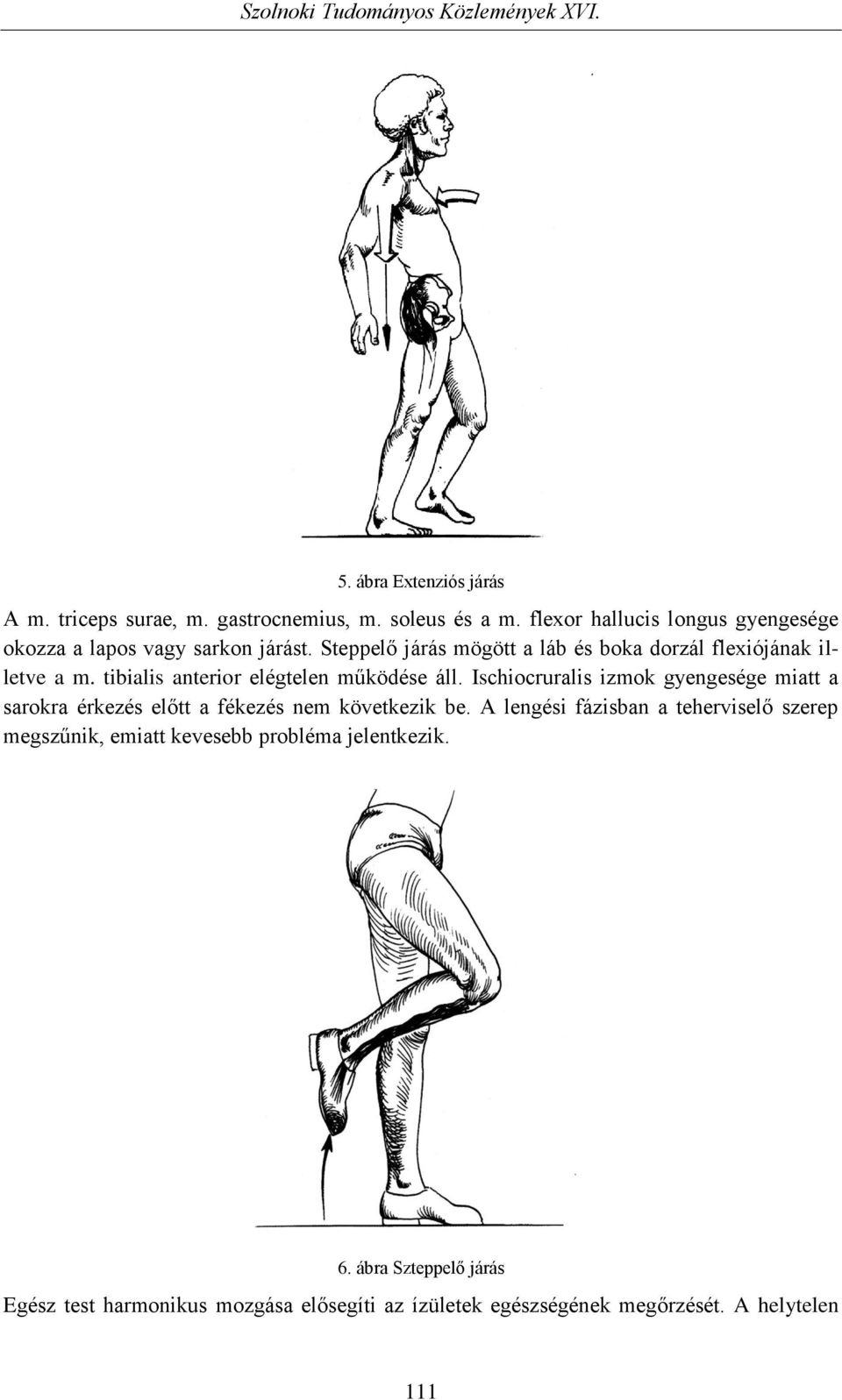 tibialis anterior elégtelen működése áll. Ischiocruralis izmok gyengesége miatt a sarokra érkezés előtt a fékezés nem következik be.