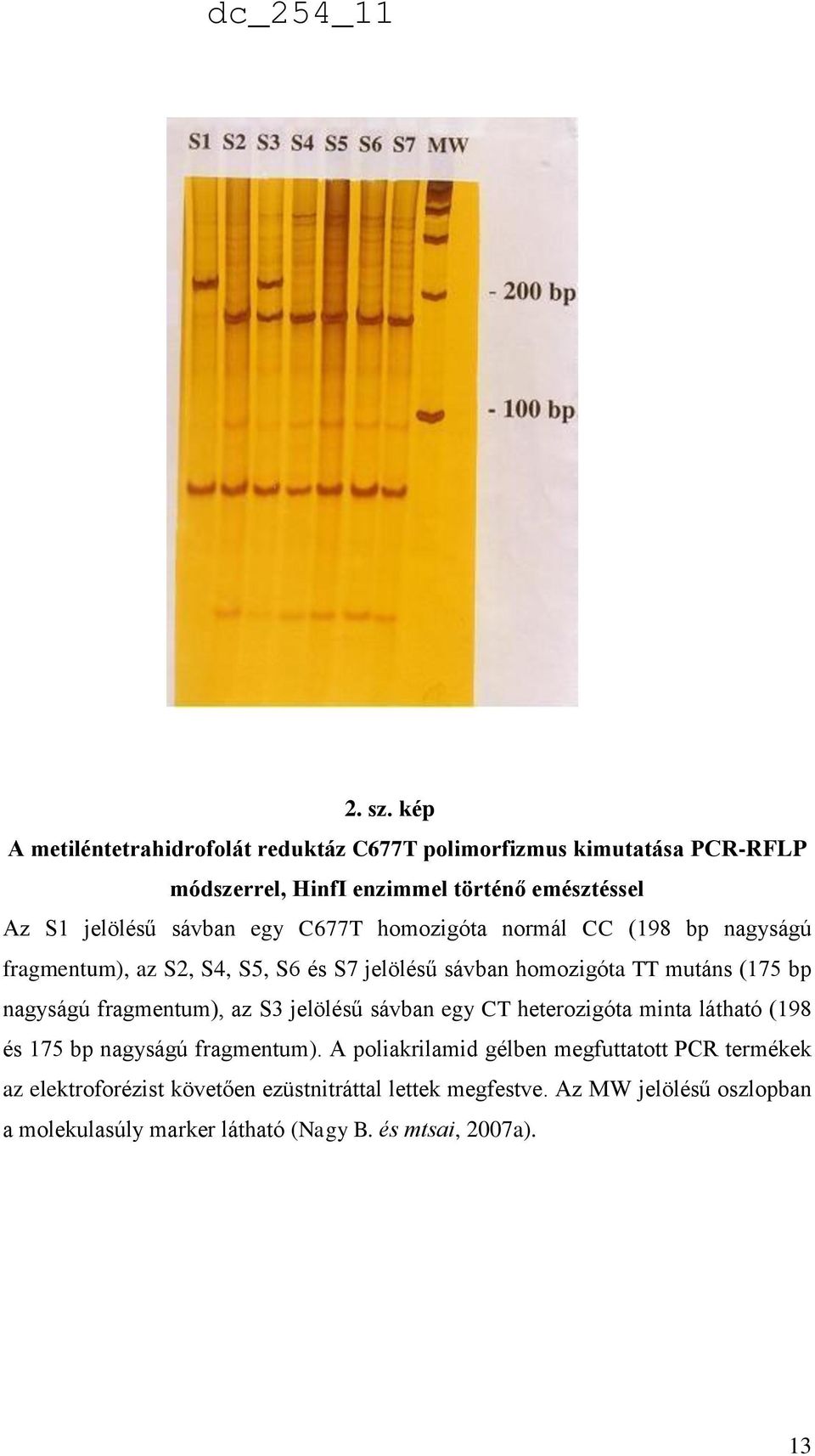 egy C677T homozigóta normál CC (198 bp nagyságú fragmentum), az S2, S4, S5, S6 és S7 jelölésű sávban homozigóta TT mutáns (175 bp nagyságú