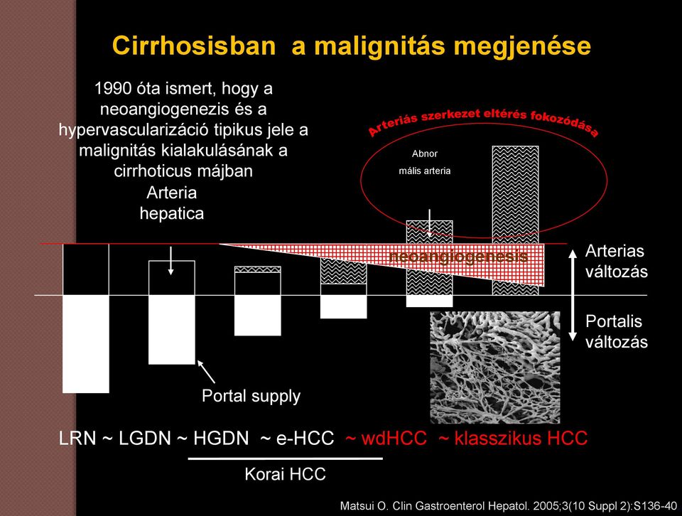 hepatica Abnor mális arteria neoangiogenesis Arterias változás Portalis változás Portal supply