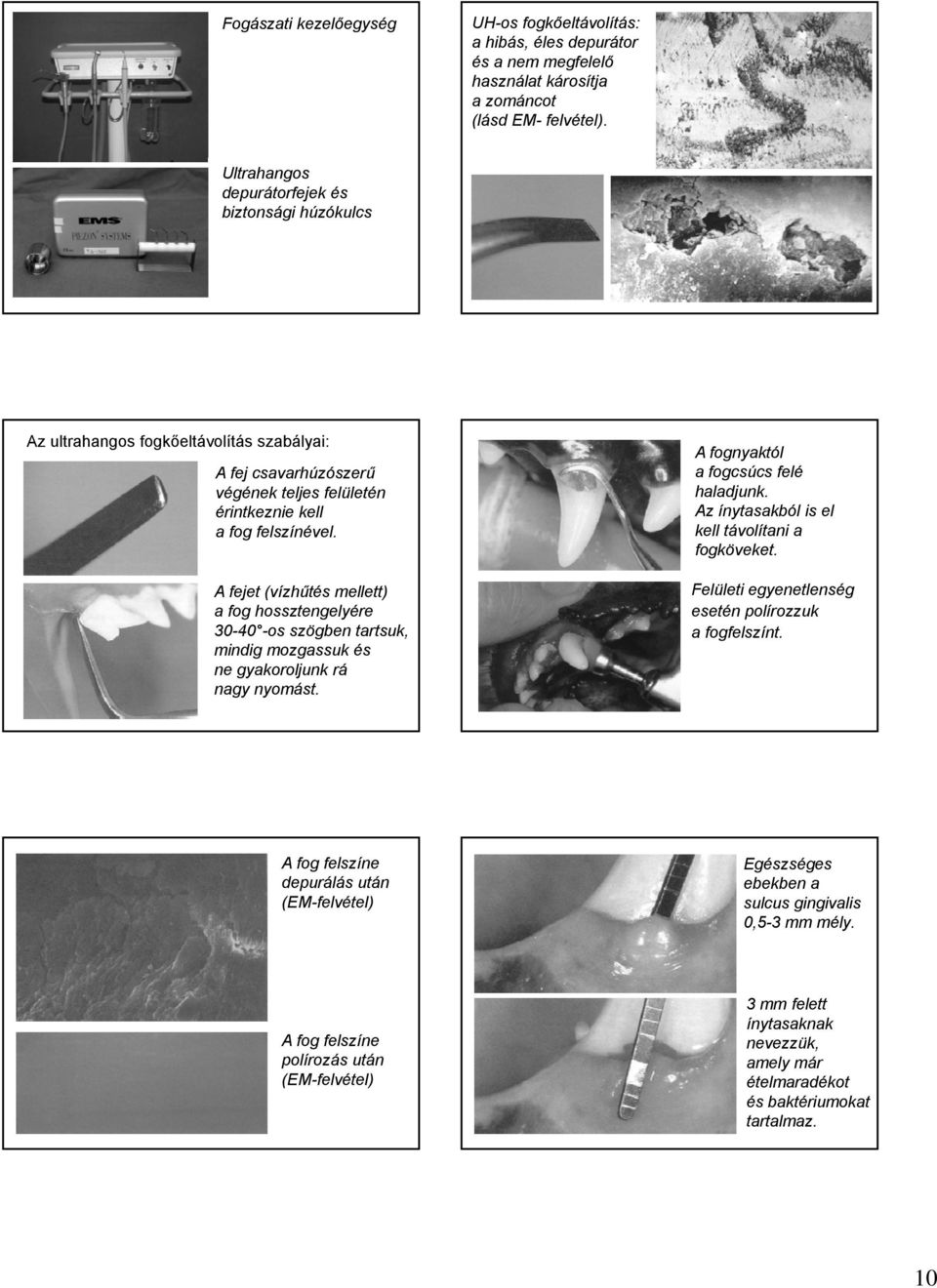 A fejet (vízhűtés mellett) a fog hossztengelyére 30-40 -os szögben tartsuk, mindig mozgassuk és ne gyakoroljunk rá nagy nyomást.