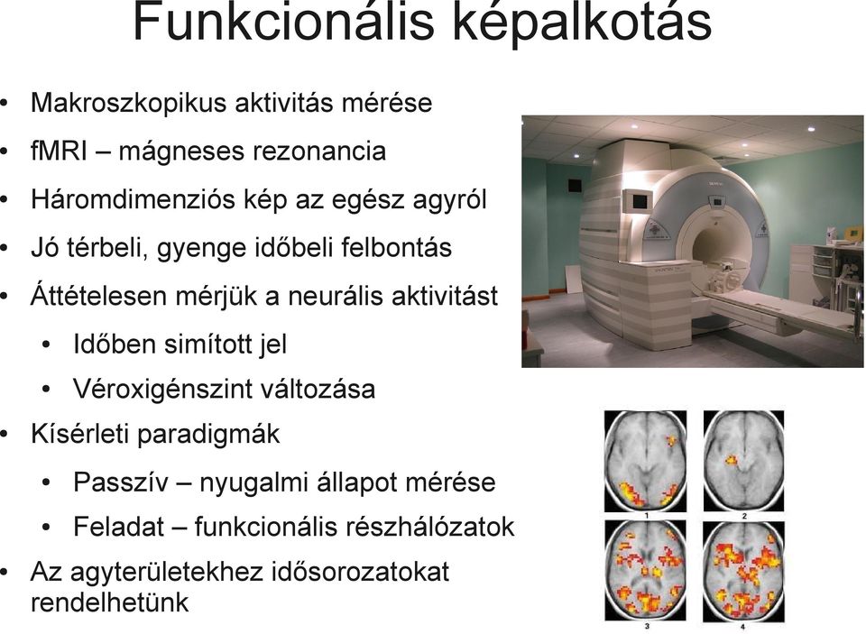 neurális aktivitást Időben simított jel Véroxigénszint változása Kísérleti paradigmák Passzív