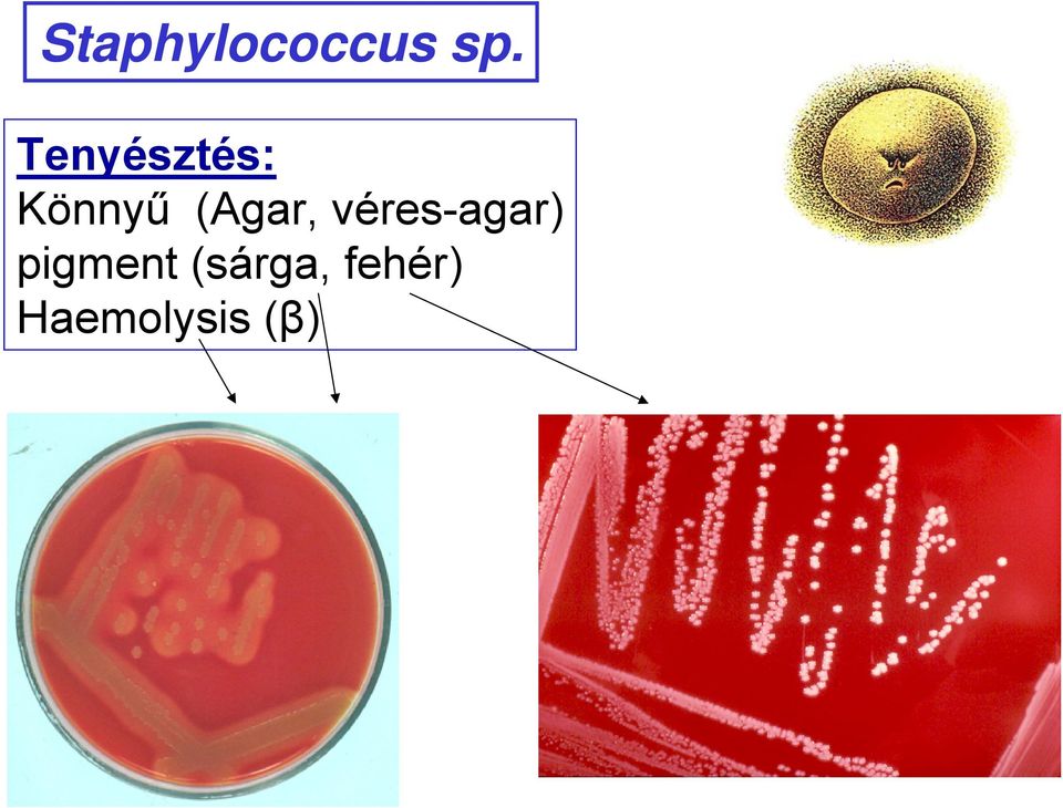 (Agar, véres-agar)