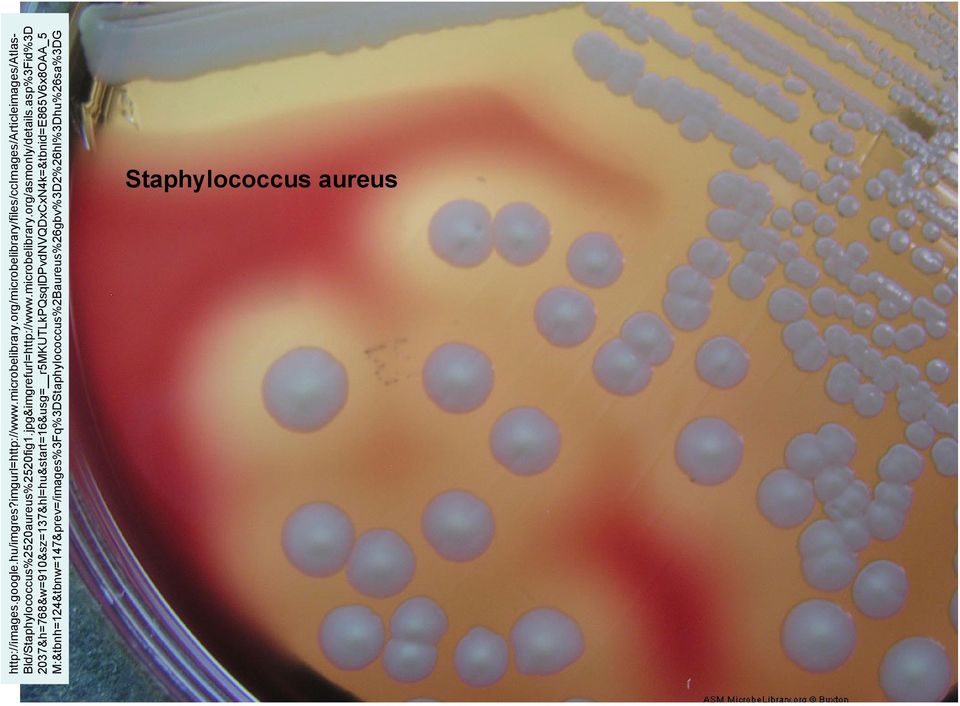 jpg&imgrefurl=http://www.microbelibrary.org/asmonly/details.