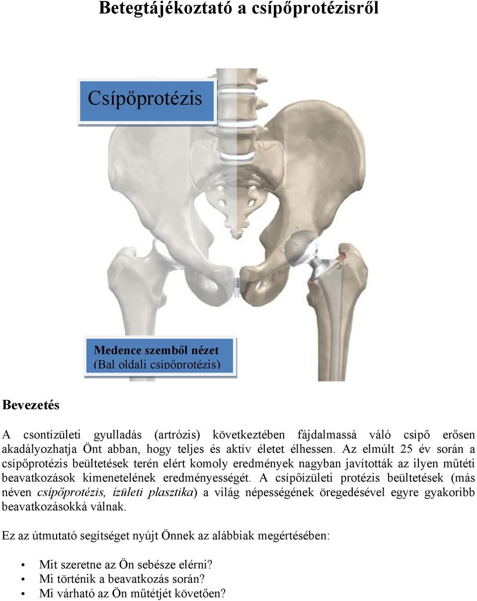 Az elmúlt 25 év során a csípőprotézis beültetések terén elért komoly eredmények nagyban javították az ilyen műtéti beavatkozások kimenetelének eredményességét.