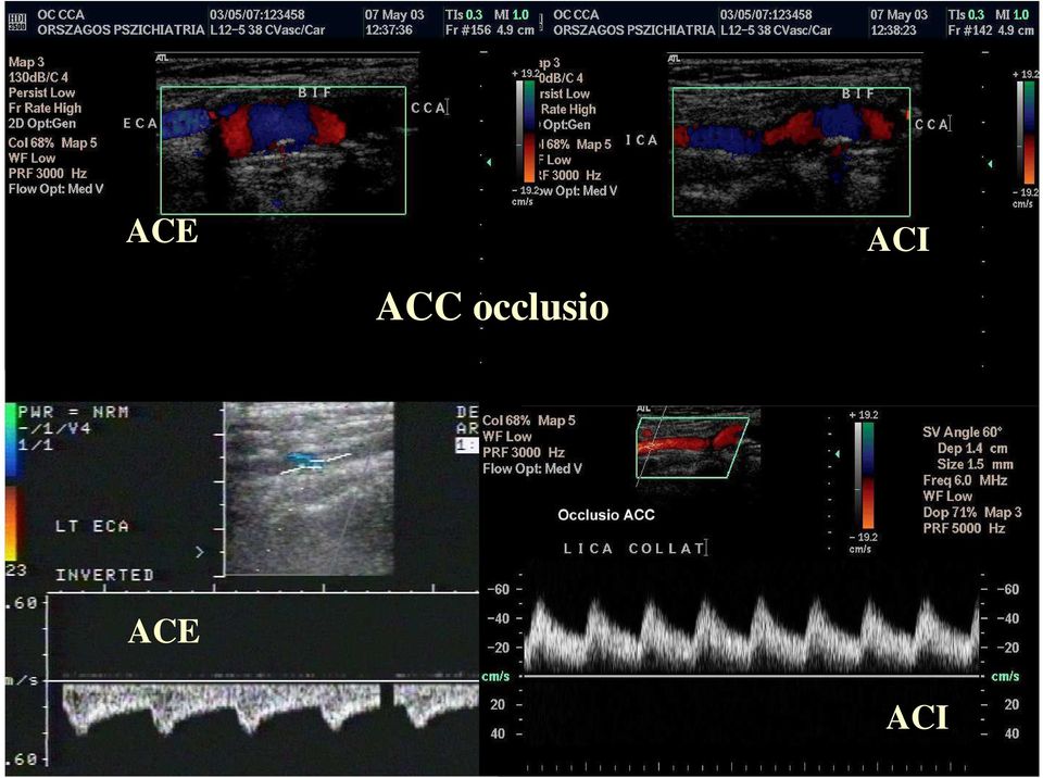 ACI ACE