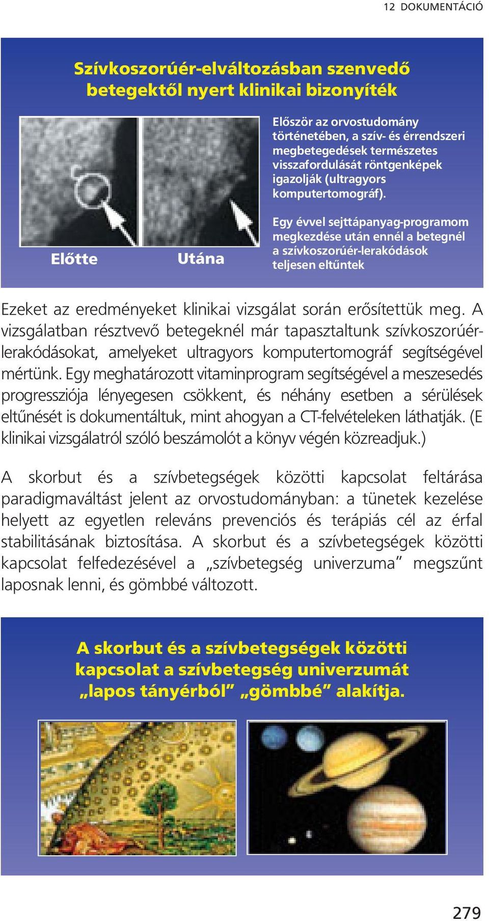 Előtte Utána Egy évvel sejttápanyag-programom megkezdése után ennél a betegnél a szívkoszorúér-lerakódások teljesen eltűntek Ezeket az eredményeket klinikai vizsgálat során erősítettük meg.