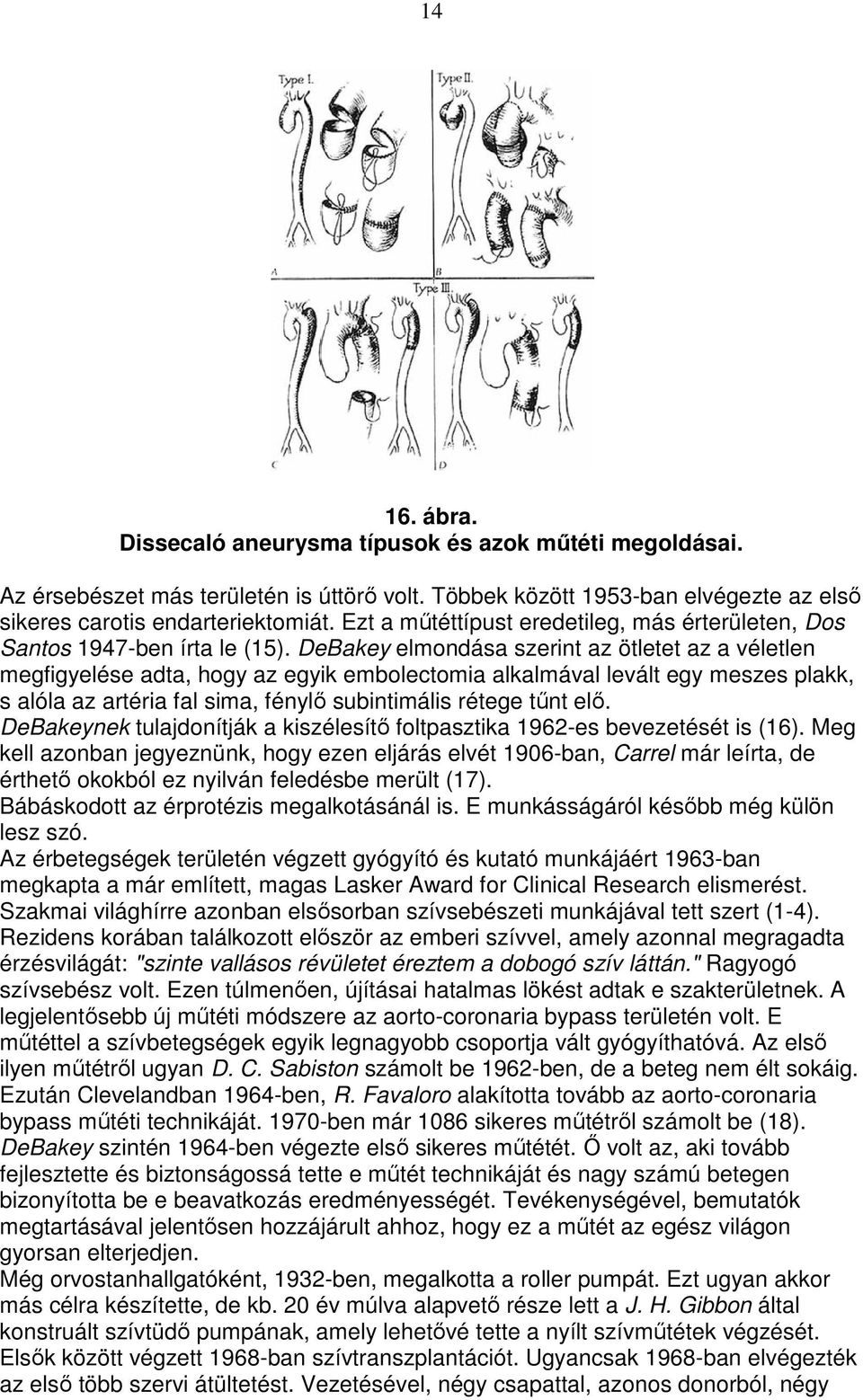 DeBakey elmondása szerint az ötletet az a véletlen megfigyelése adta, hogy az egyik embolectomia alkalmával levált egy meszes plakk, s alóla az artéria fal sima, fénylı subintimális rétege tőnt elı.