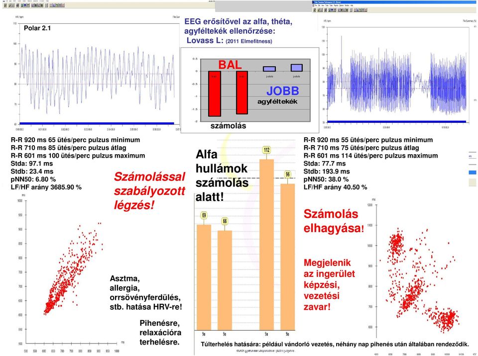 90 % Számolással szabályozott légzés! Alfa hullámok számolás alatt! R-R 920 ms 55 ütés/perc pulzus minimum R-R 710 ms 75 ütés/perc pulzus átlag R-R 601 ms 114 ütés/perc pulzus maximum Stda: 77.