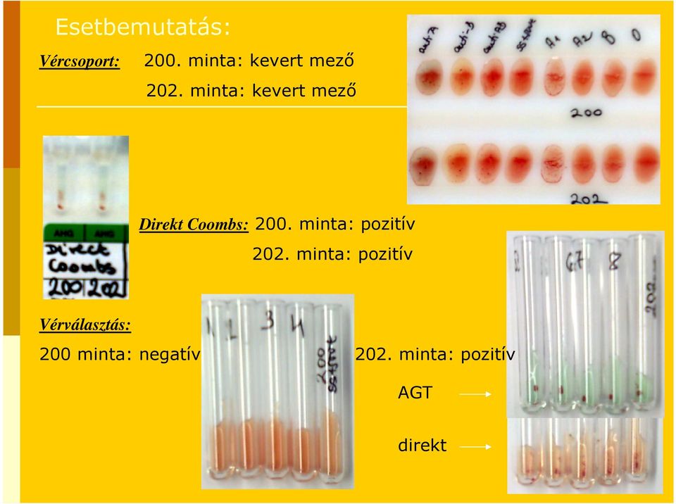 minta: kevert mezı Direkt Coombs: 200.