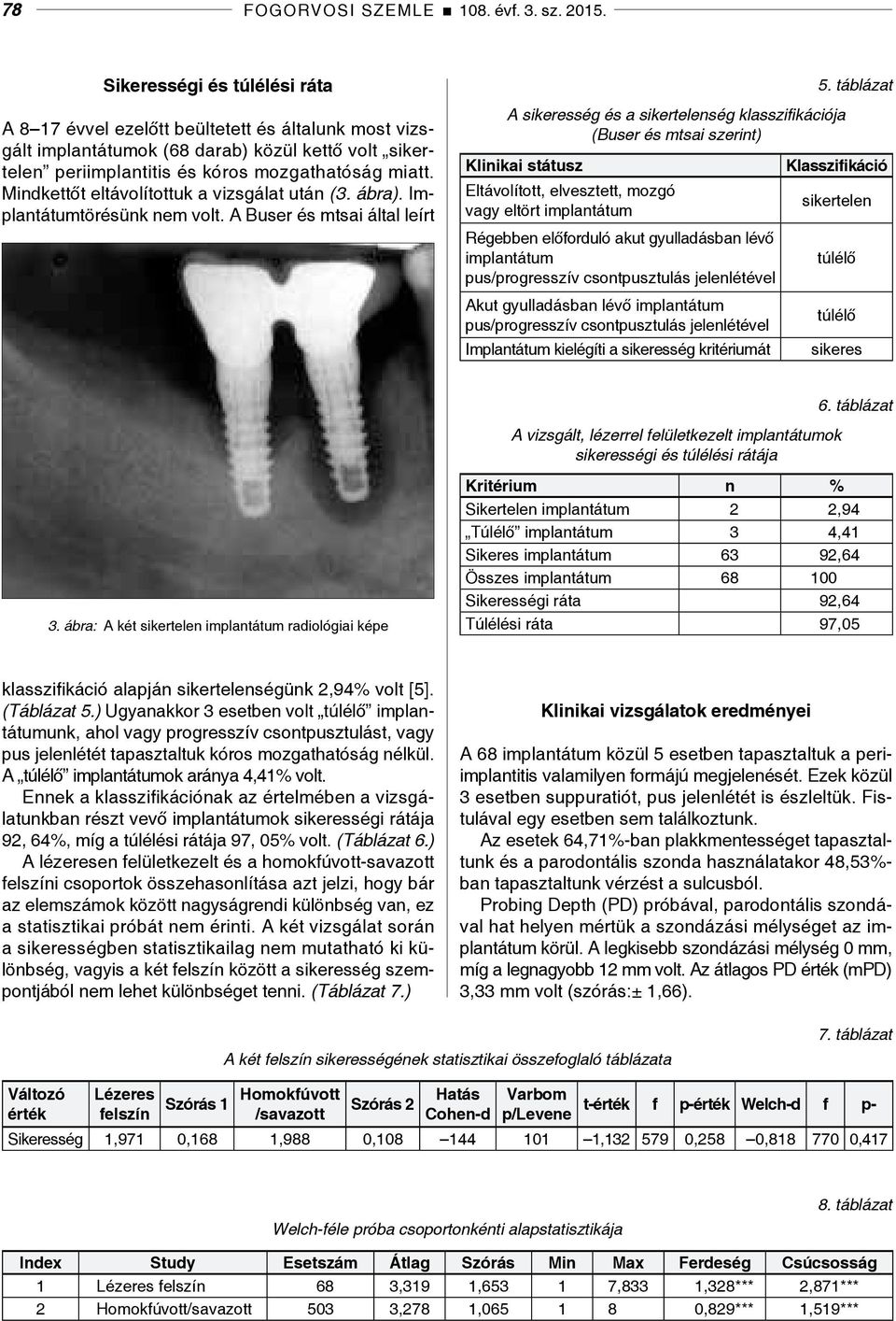 Mindkettőt eltávolítottuk a vizsgálat után (3. ábra). Implantátumtörésünk nem volt. A Buser és mtsai által leírt A sikeresség és a sikertelenség klasszifikációja (Buser és mtsai szerint) 5.