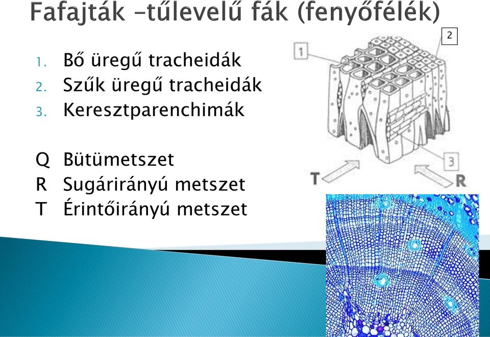 Keresztparenchimák 2 Q