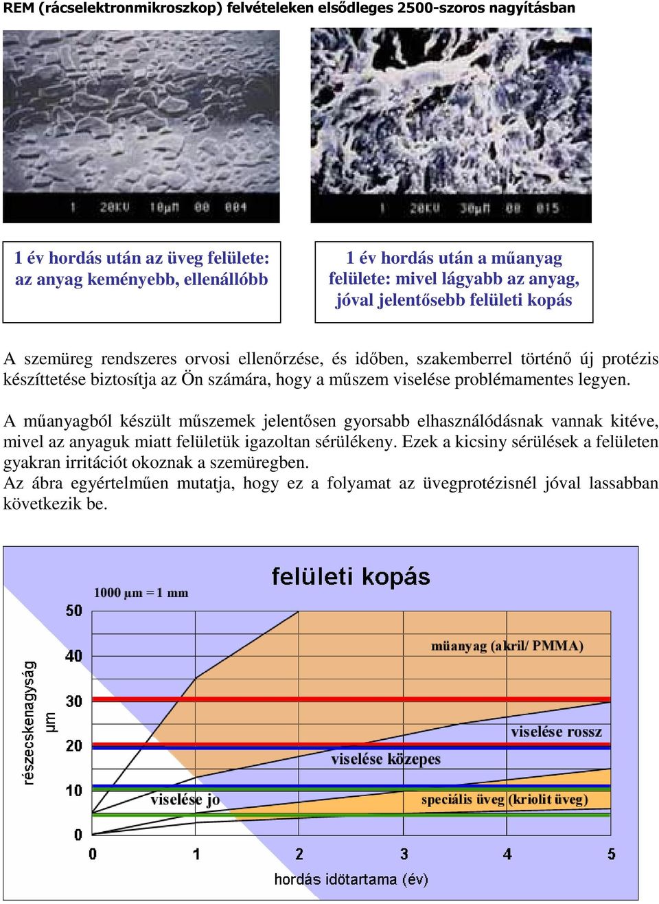 számára, hogy a mőszem viselése problémamentes legyen.