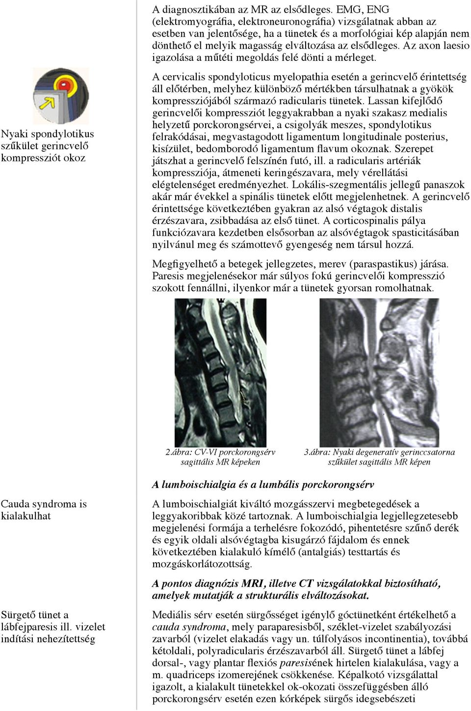 Az axon laesio igazolása a műtéti megoldás felé dönti a mérleget.