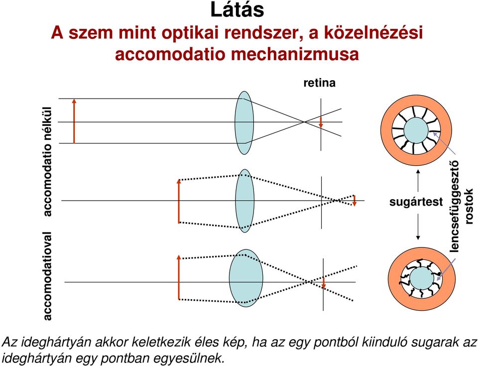 lencsefüggesztı rostok Az ideghártyán akkor keletkezik éles kép,