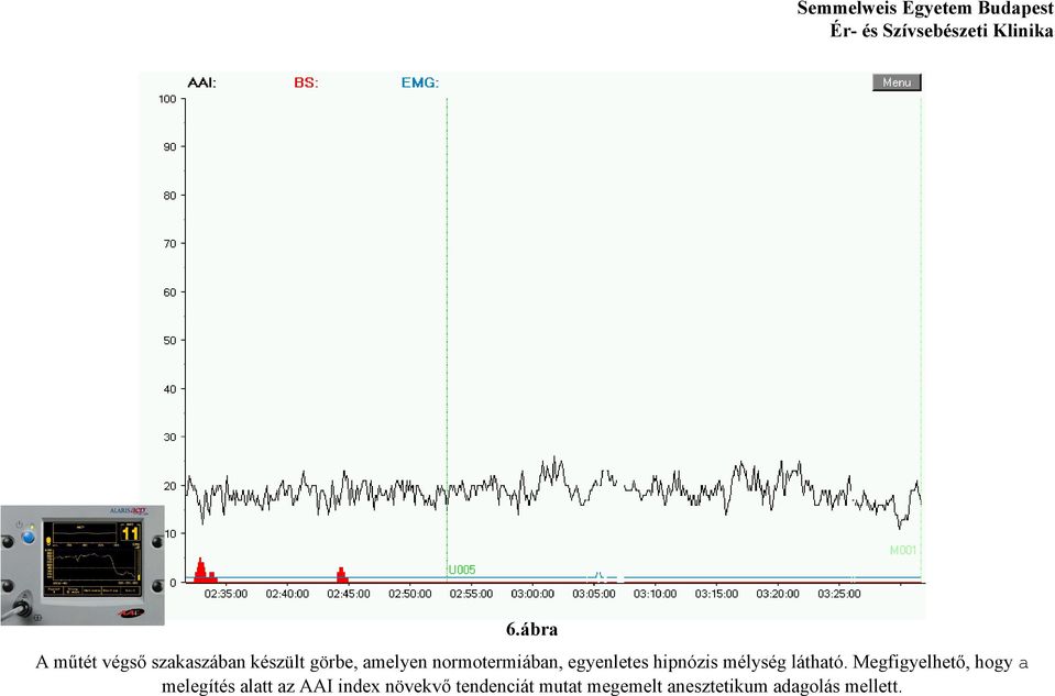 normotermiában, egyenletes hipnózis mélység látható.
