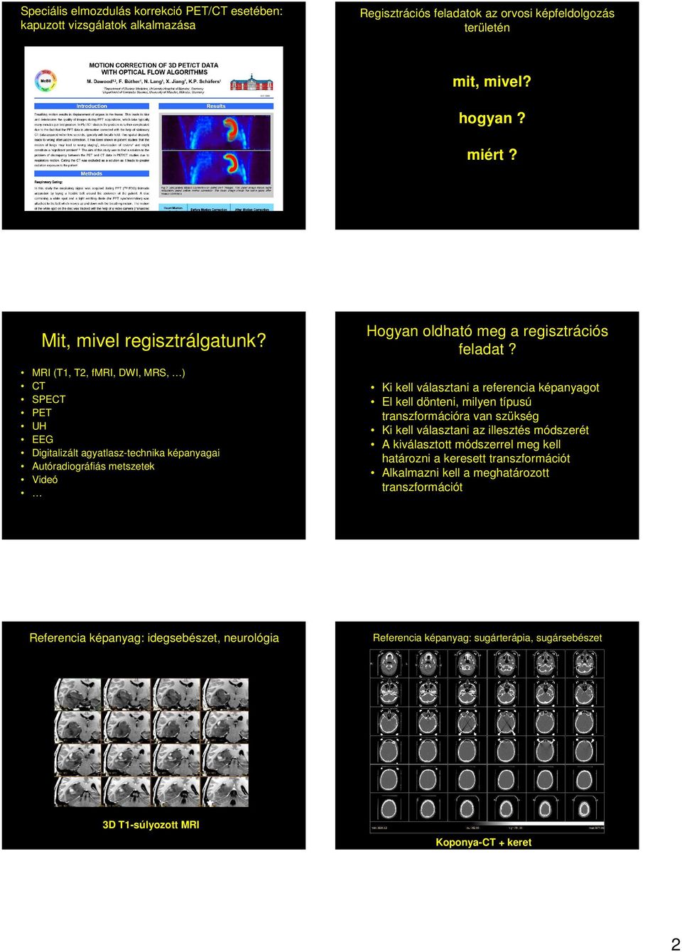 MRI (T1, T2, fmri, DWI, MRS, ) CT SPECT PET UH EEG Digitalizált agyatlasz-technika ai Autóradiográfiás metszetek Videó Hogyan oldható meg a regisztrációs feladat?