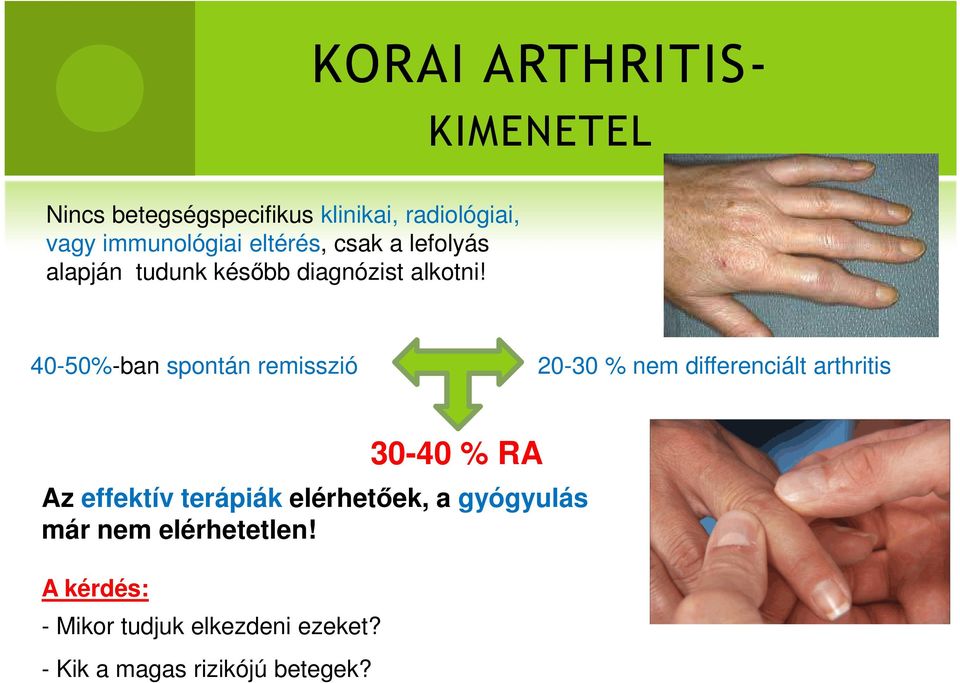 40-50%-ban spontán remisszió 20-30 % nem differenciált arthritis 30-40 % RA Az effektív