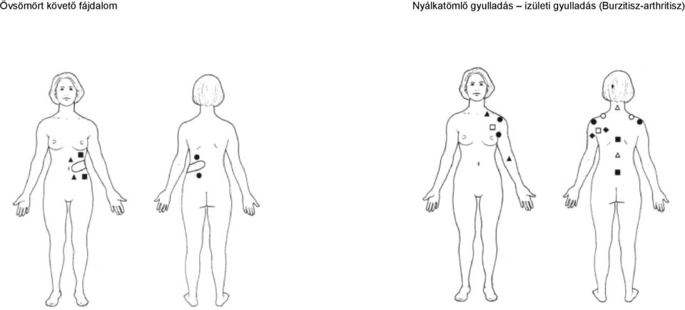 gyulladás izületi