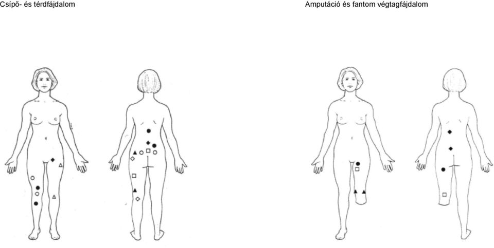 Amputáció és
