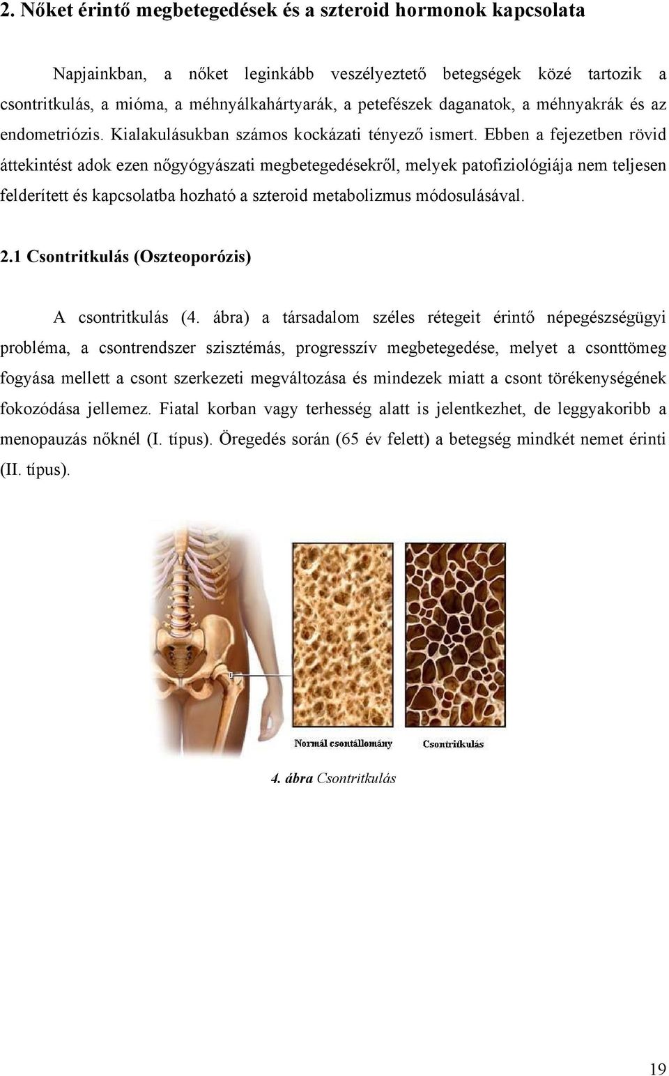 Ebben a fejezetben rövid áttekintést adok ezen nőgyógyászati megbetegedésekről, melyek patofiziológiája nem teljesen felderített és kapcsolatba hozható a szteroid metabolizmus módosulásával. 2.