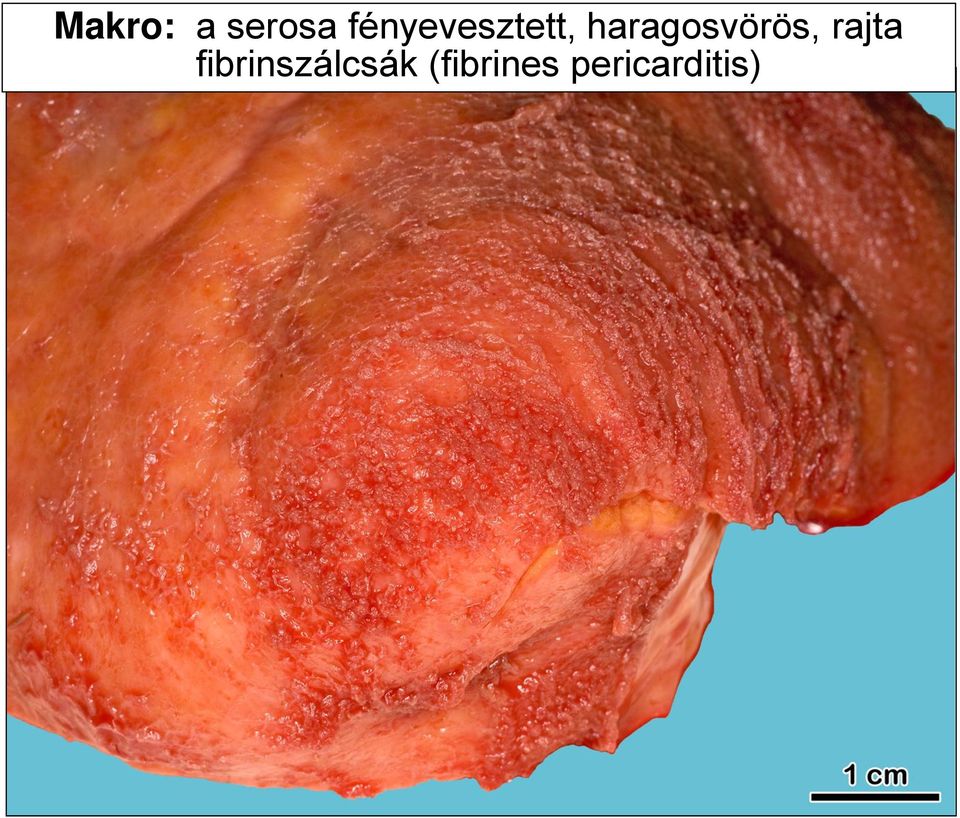 haragosvörös, rajta