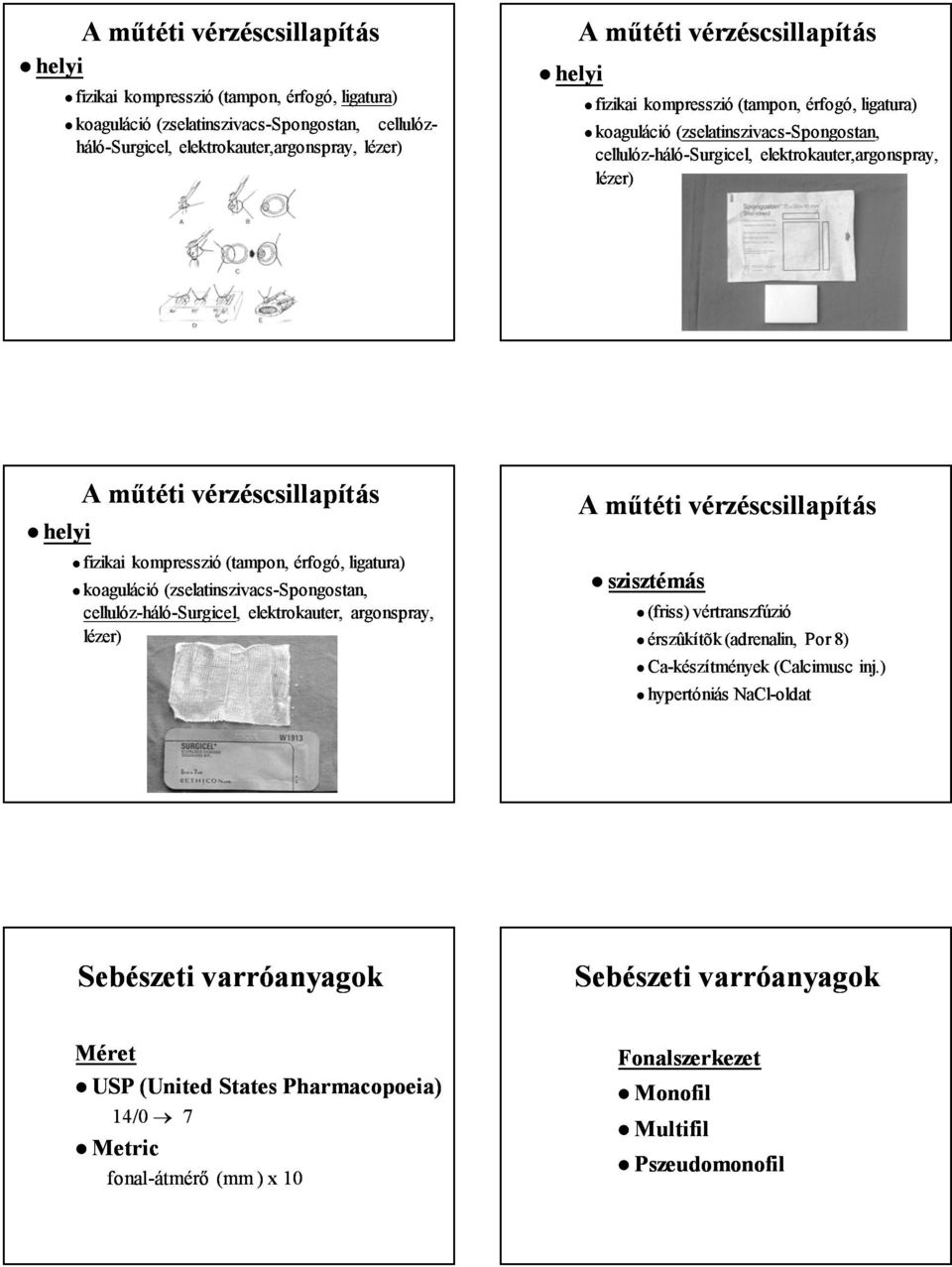 műtéti vérzéscsillapítás fizikai kompresszió (tampon, érfogó, ligatura) koaguláció (zselatinszivacsspongostan, cellulózháló hálósurgicel Surgicel, elektrokauter, argonspray, lézer) A műtéti