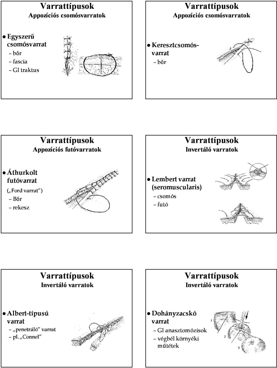 varrat ) Bőr rekesz Lembert varrat (seromuscularis) csomós futó Varrattípusok Invertáló varratok Varrattípusok Invertáló