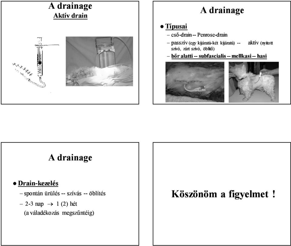 subfascialis mellkasi hasi Drainkezelés spontán ürülés szívás