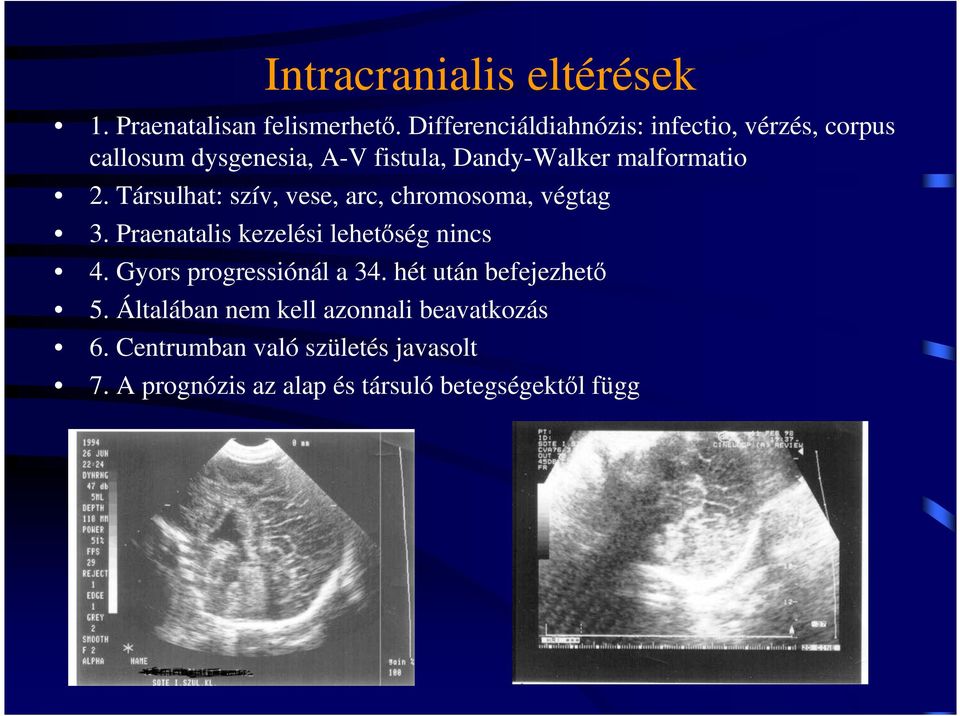 Társulhat: szív, vese, arc, chromosoma, végtag 3. Praenatalis kezelési lehetıség nincs 4.