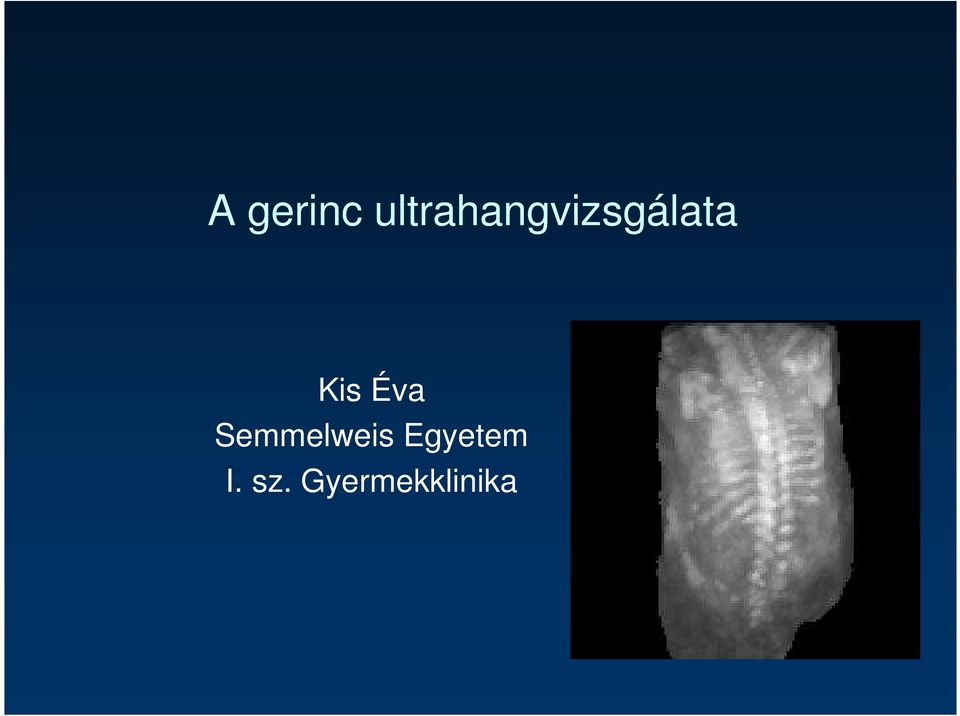 Kis Éva Semmelweis