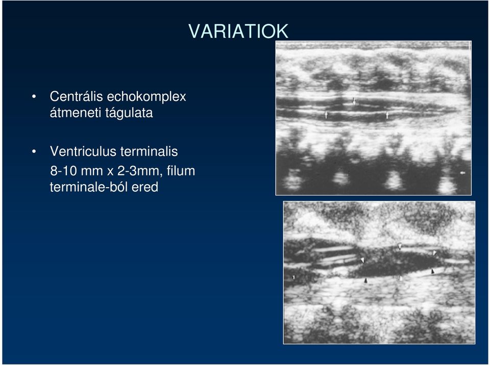 tágulata Ventriculus