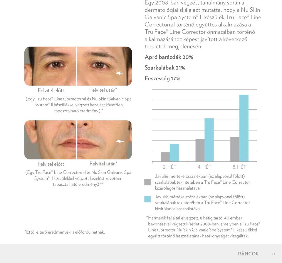 Correctorral és Nu Skin Galvanic Spa System II készülékkel végzett kezelést követően tapasztalható eredmény.