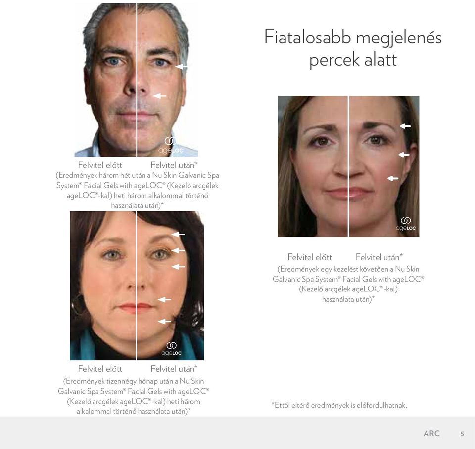 System Facial Gels with ageloc (Kezelő arcgélek ageloc -kal) használata után)* Felvitel előtt Felvitel után* (Eredmények tizennégy hónap után a Nu Skin