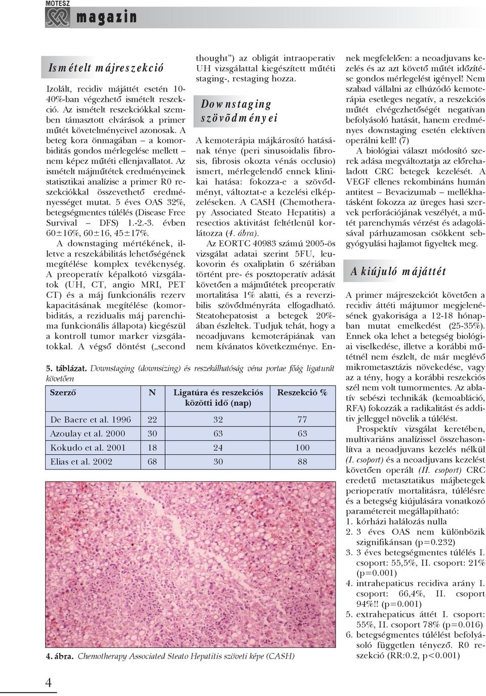 Az ismételt májmûtétek eredményeinek statisztikai analízise a primer R0 reszekciókkal összevethetõ eredményességet mutat. 5 éves OAS 32%, betegségmentes túlélés (Disease Free Survival DFS) 1.-2.-3.
