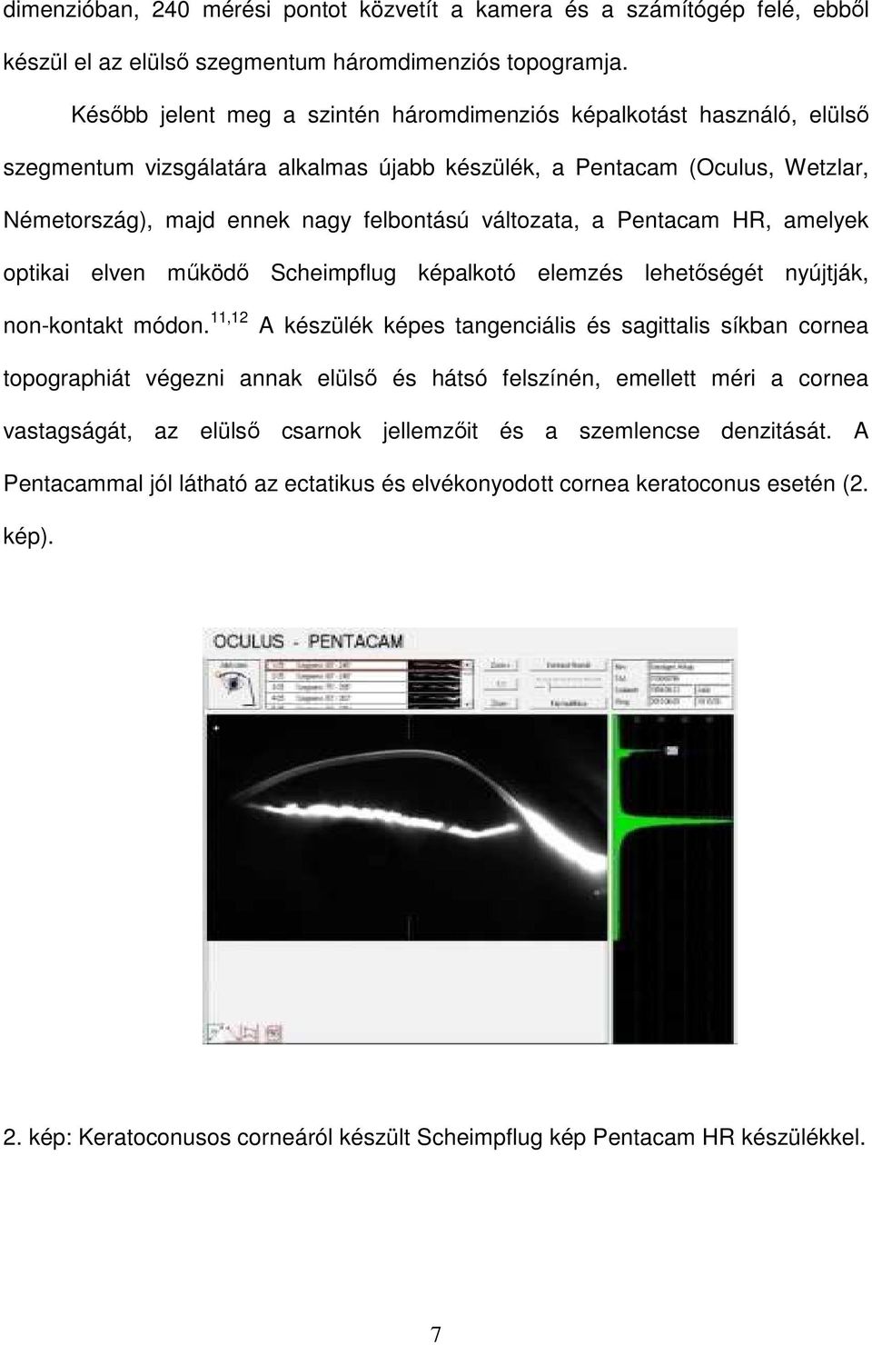 változata, a Pentacam HR, amelyek optikai elven működő Scheimpflug képalkotó elemzés lehetőségét nyújtják, non-kontakt módon.