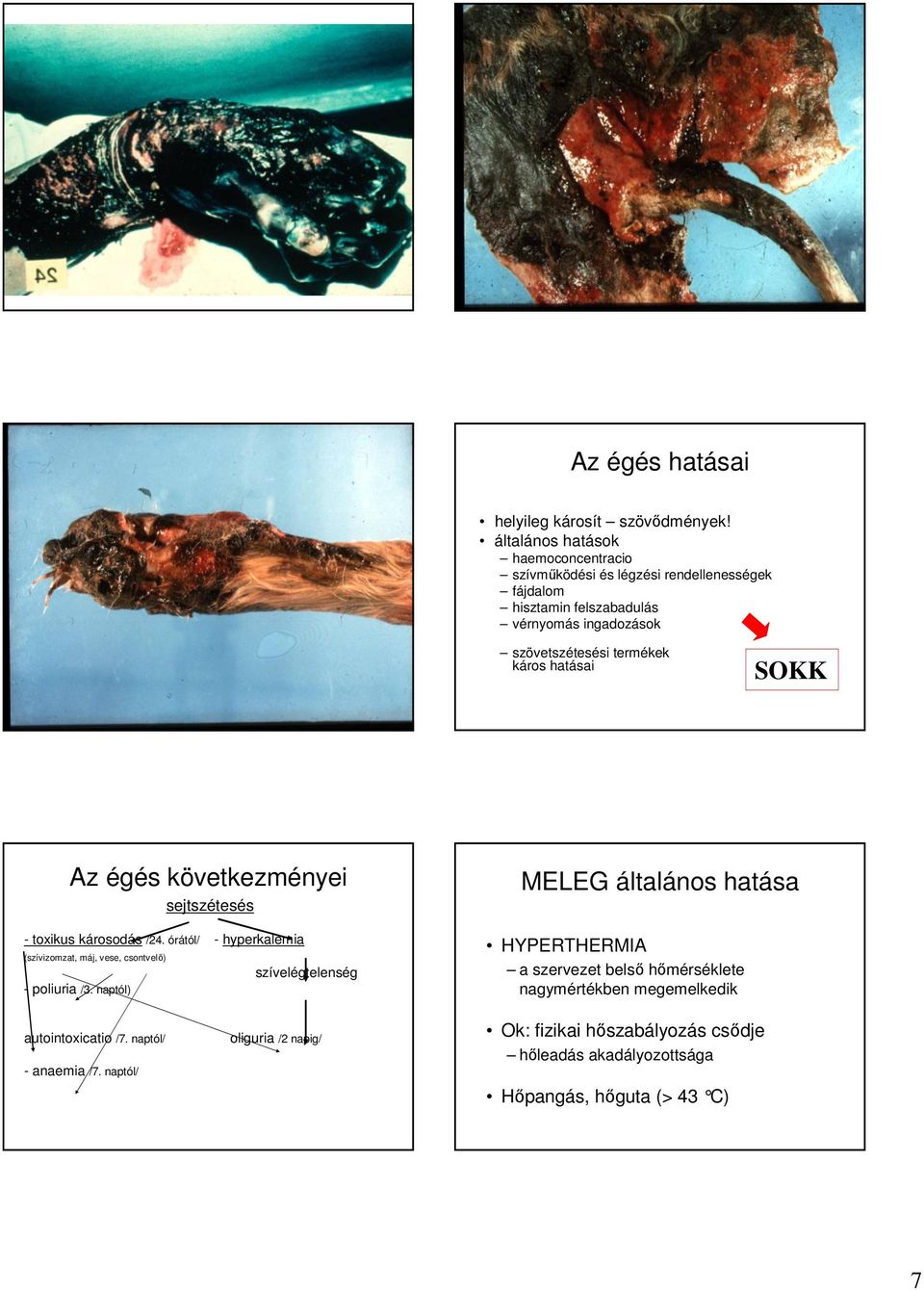 káros hatásai SOKK Az égés következményei sejtszétesés - toxikus károsodás /24.