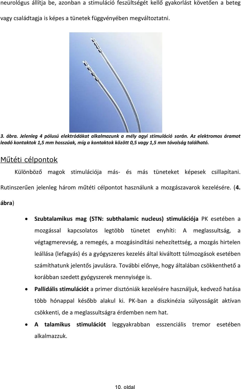 Műtéti célpontok Különböző magok stimulációja más- és más tüneteket képesek csillapítani. Rutinszerűen jelenleg három műtéti célpontot használunk a mozgászavarok kezelésére. (4.