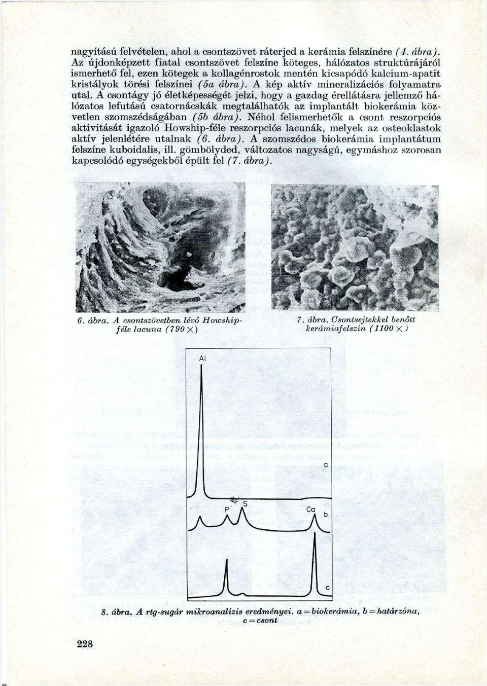 A kép aktív mineralizációs folyamatra utal.