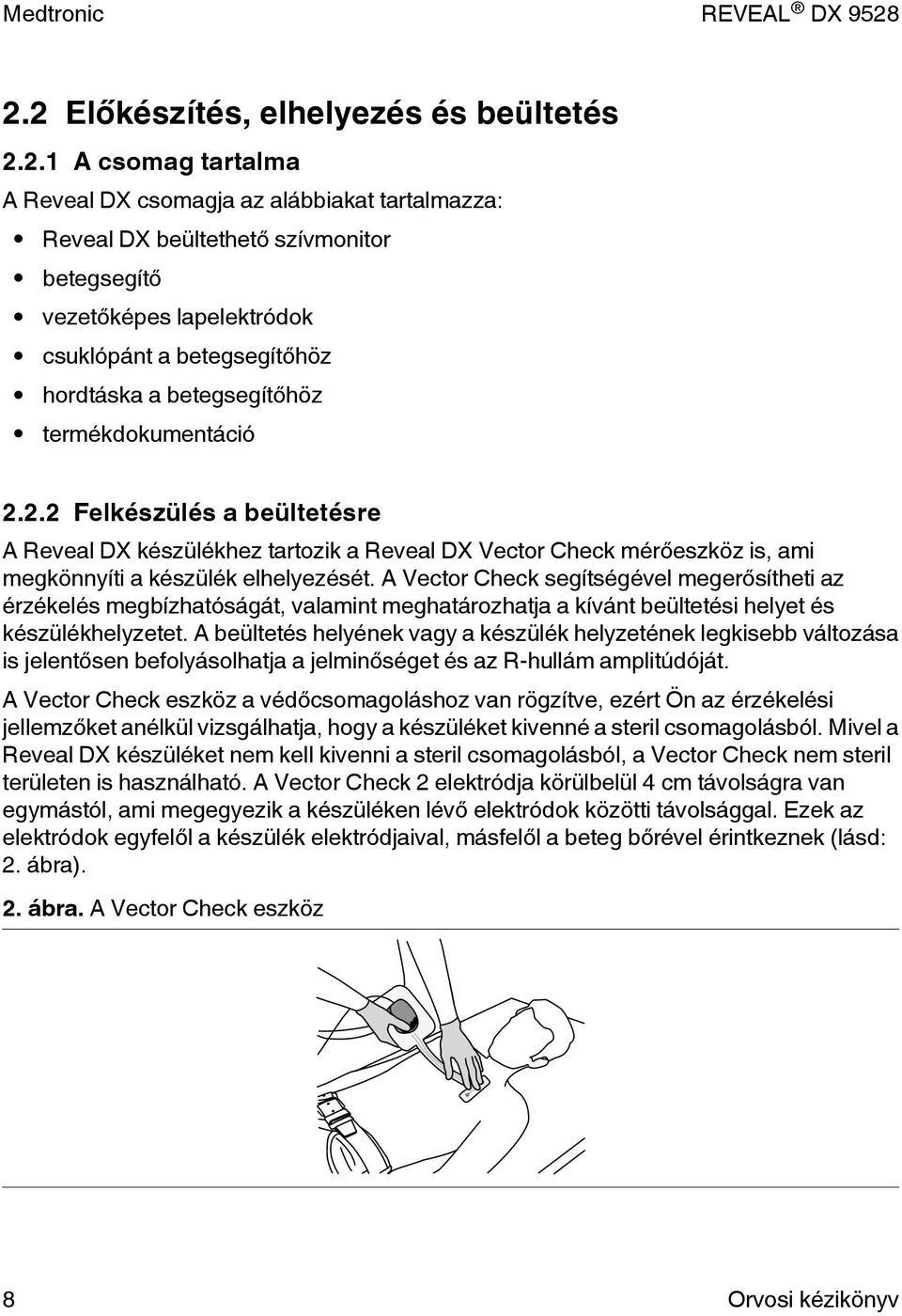 2.2 Felkészülés a beültetésre A Reveal DX készülékhez tartozik a Reveal DX Vector Check mérőeszköz is, ami megkönnyíti a készülék elhelyezését.