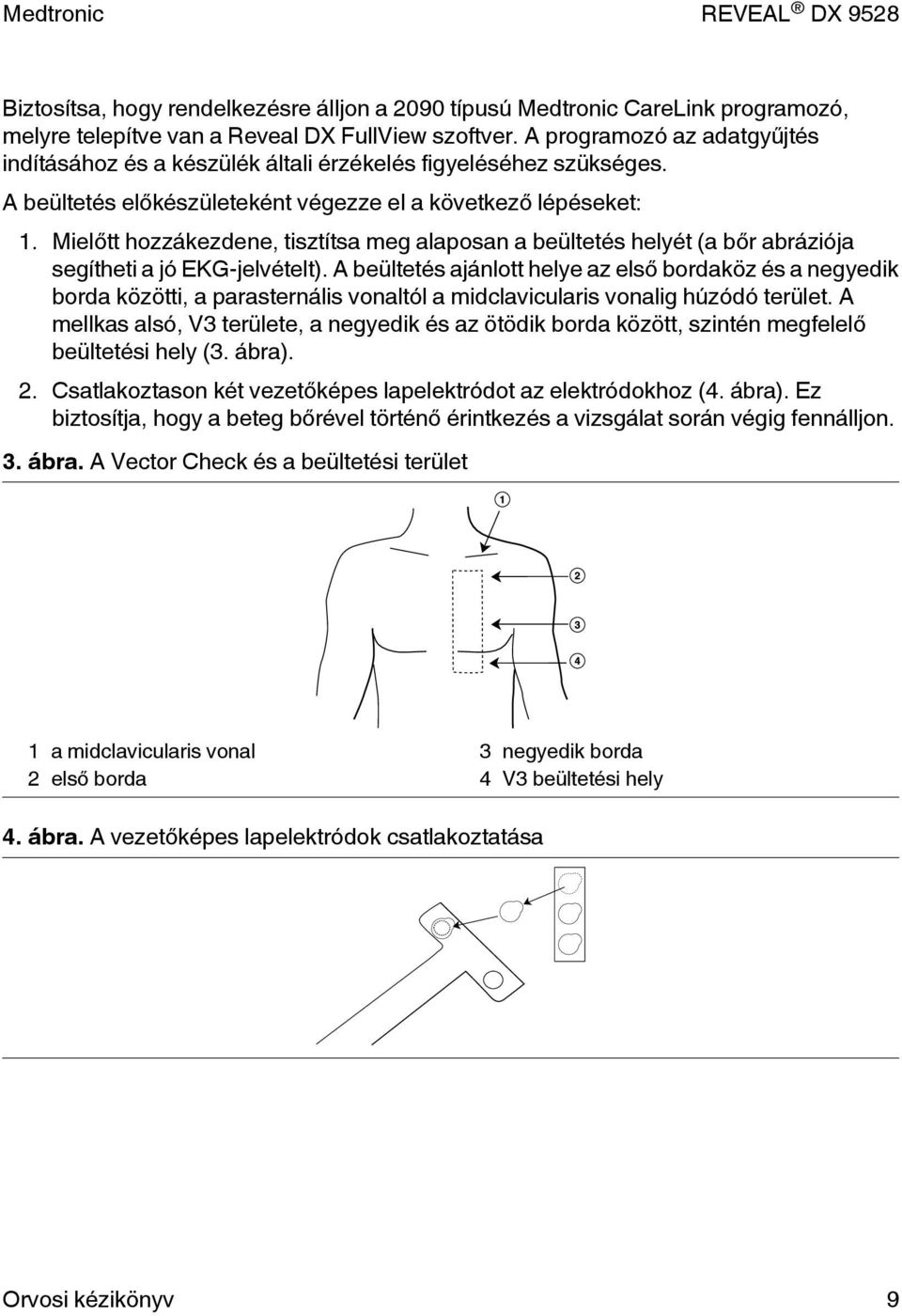 Mielőtt hozzákezdene, tisztítsa meg alaposan a beültetés helyét (a bőr abráziója segítheti a jó EKG-jelvételt).