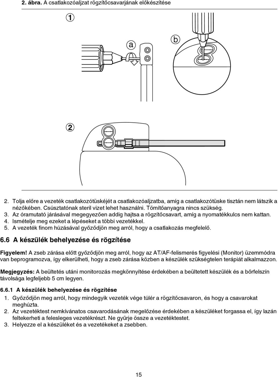 Ismételje meg ezeket a lépéseket a többi vezetékkel. 5. A vezeték finom húzásával győződjön meg arról, hogy a csatlakozás megfelelő. 6.6 A készülék behelyezése és rögzítése Figyelem!