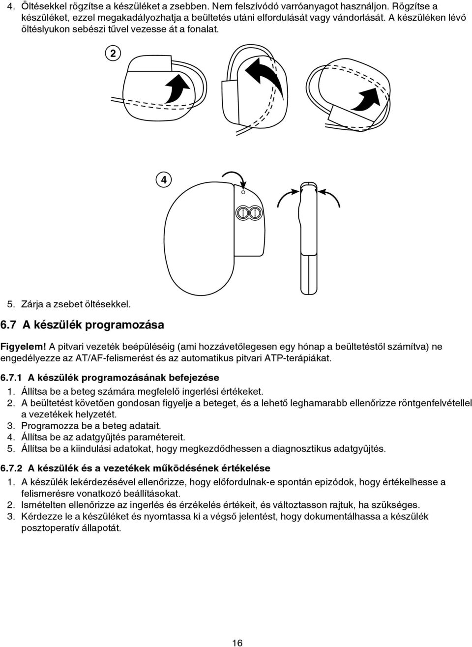 A pitvari vezeték beépüléséig (ami hozzávetőlegesen egy hónap a beültetéstől számítva) ne engedélyezze az AT/AF-felismerést és az automatikus pitvari ATP-terápiákat. 6.7.