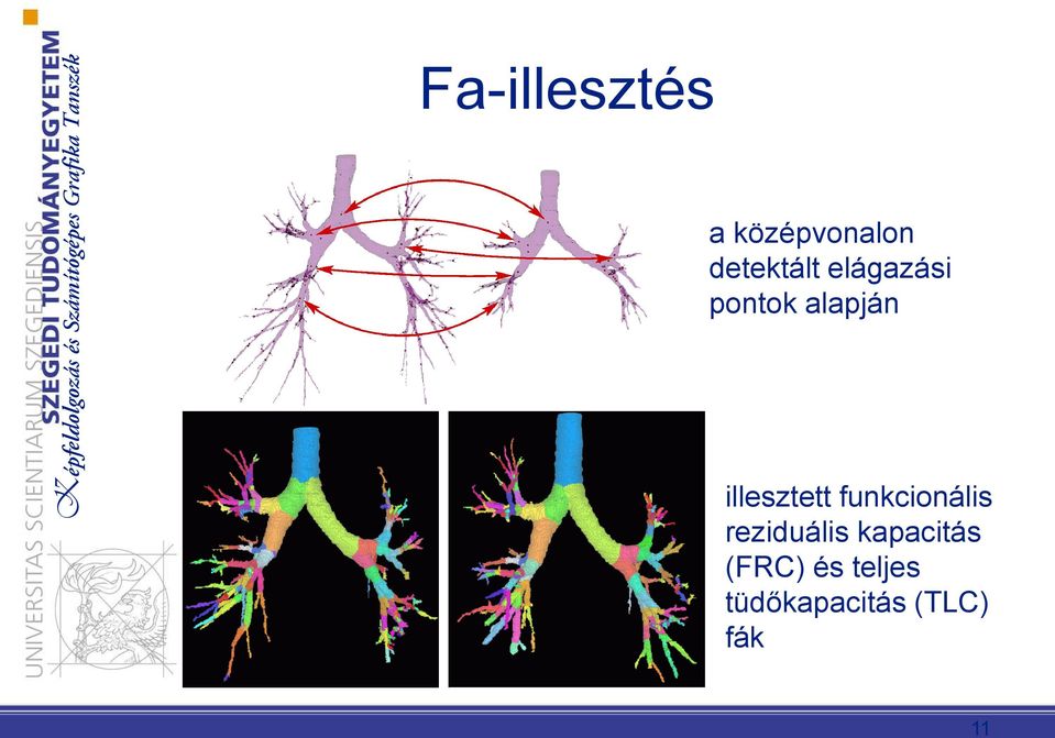 funkcionális reziduális kapacitás