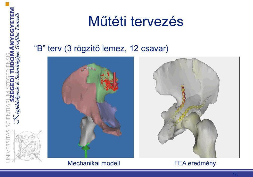 lemez, 12 csavar)